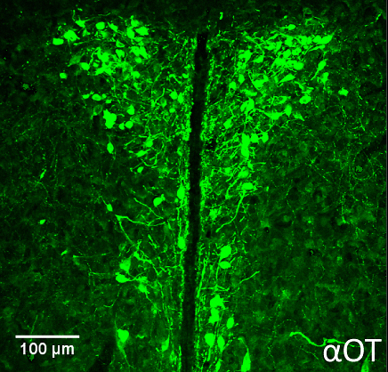 תאי עצב המייצרים אוקסיטוצין בגרעין הפאראוונטריקולרי (PVN) בהיפותלמוס של עכברים (צילום: מסע הקסם המדעי, מכון ויצמן)