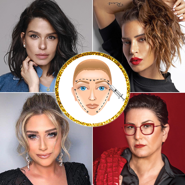 תרבות הניתוחים הפלסטיים (צילום: גבריאל בהרליה, דניאל קמינסקי, טל עבודי, אינסטגרם) תרבות הניתוחים הפלסטיים (צילום: גבריאל בהרליה, דניאל קמינסקי, טל עבודי, אינסטגרם)