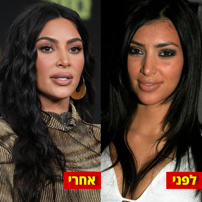 האף, עור הפנים, הכל שם שונה! (צילום: Gettyimages) האף, עור הפנים, הכל שם שונה! (צילום: Gettyimages)