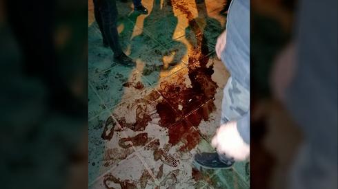 Blood from protesters shot in Iran  (Photo: AP)