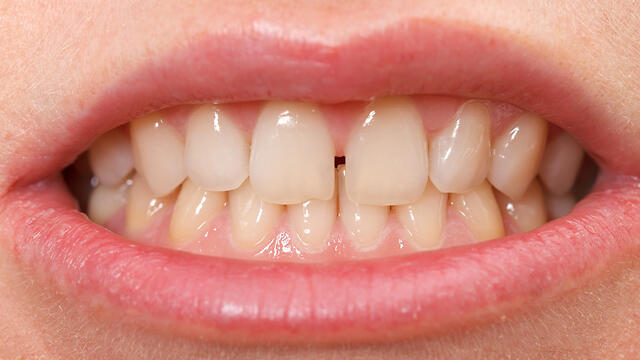 צילום: shutterstock צילום: shutterstock
