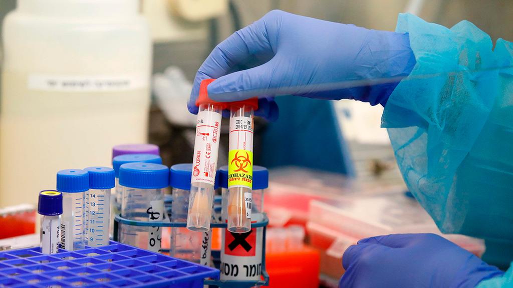 Комплекты для анализов на коронавирус в больнице "Ихилов" в Тель-Авиве. Фото: AFP (  )