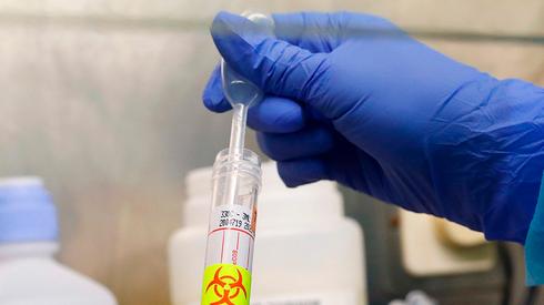 Testing for coronavirus  (Photo: AFP)