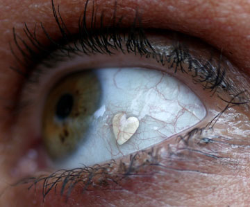הכנסת לב טיטניום לתוך העין (צילום: gettyimages)
