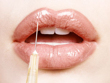 מילוי שפתיים - לא רק בוטוקס (צילום: thinkstock)