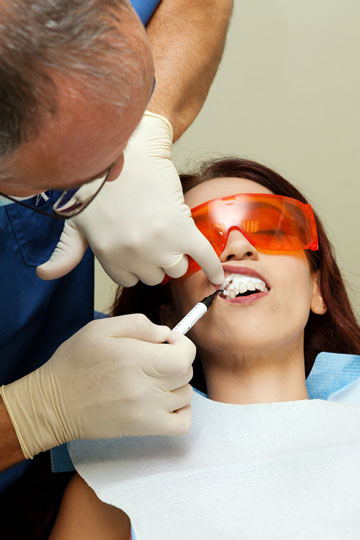 גומי, חומר פעיל ורופא חביב. הלבנת השיניים בפעולה (צילום: ענבל מרמרי)